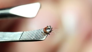Zecke, die richtig entfernt wurde, wird mit einer Pinzette gehalten